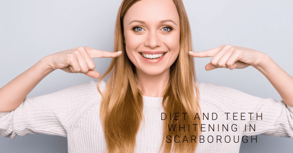 Diet and Teeth Whitening in Scarborough