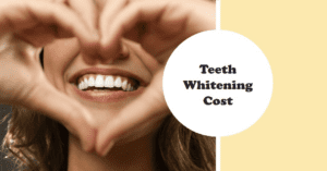 Cost of Teeth Whitening Scarborough
